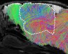 Source-feed image associated with Scientists create mice with part-human brains