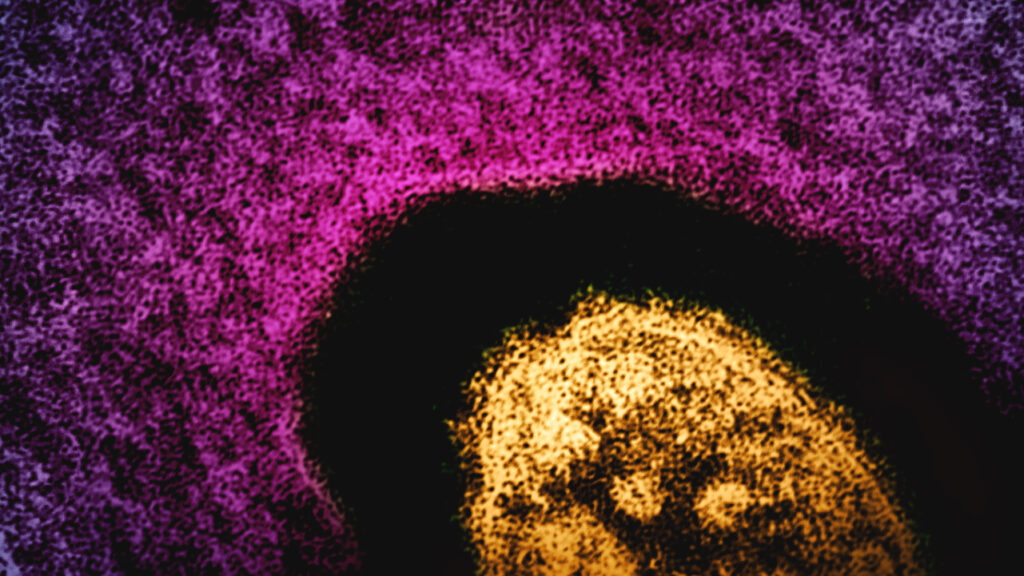 Source-feed image associated with Opinion: Make infectious disease data boring again