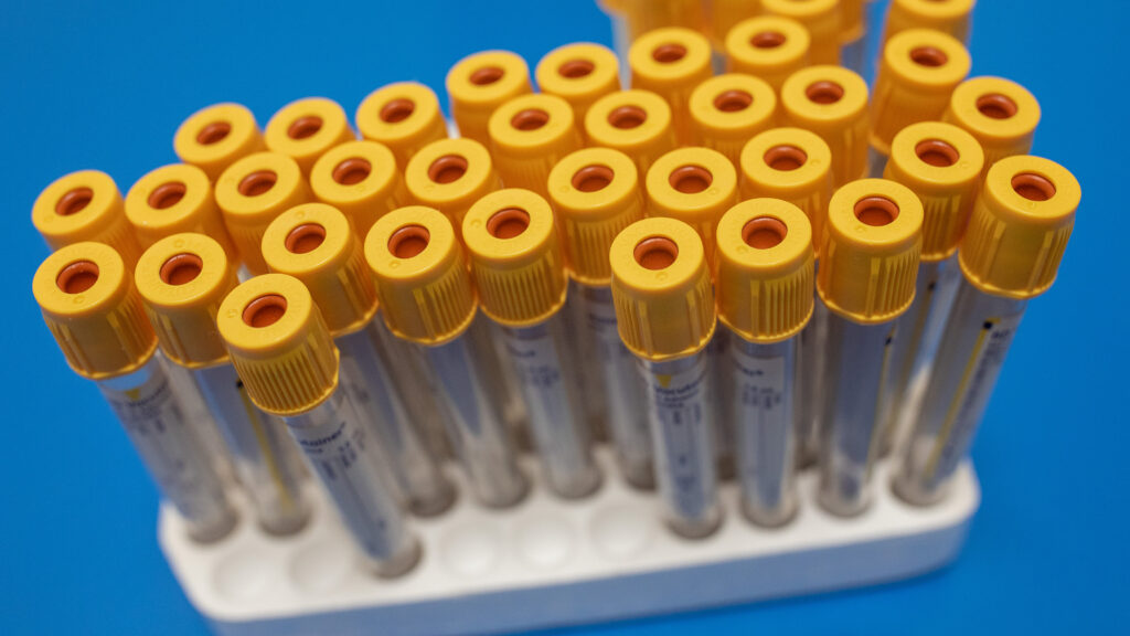 Source-feed image associated with Opinion: Stopping doctors from ordering unnecessary diagnostic tests requires a structural fix