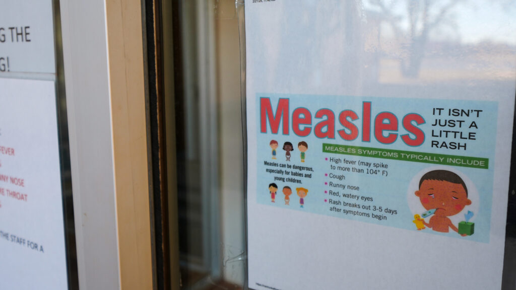 Source-feed image associated with U.S. reaches highest number of measles deaths in decades