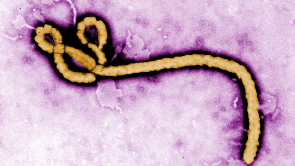 Source-feed image associated with The latest developments on Ebola, hepatitis B, long Covid