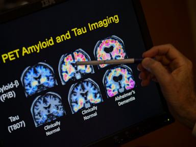 Source-feed image associated with Want to lower your risk of dementia? It doesn't involve a blood test