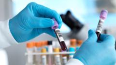 Source-feed image associated with England set to eliminate hepatitis C