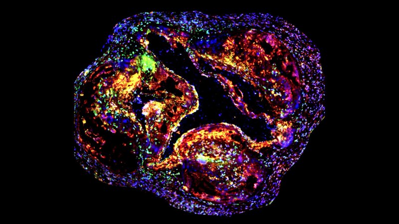 Source-feed image associated with Sleep and exercise may dampen genetic drivers of heart disease