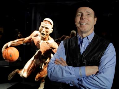 Source-feed image associated with Gunther von Hagens, the German anatomist behind the 'Body Worlds' exhibition, dies at 81