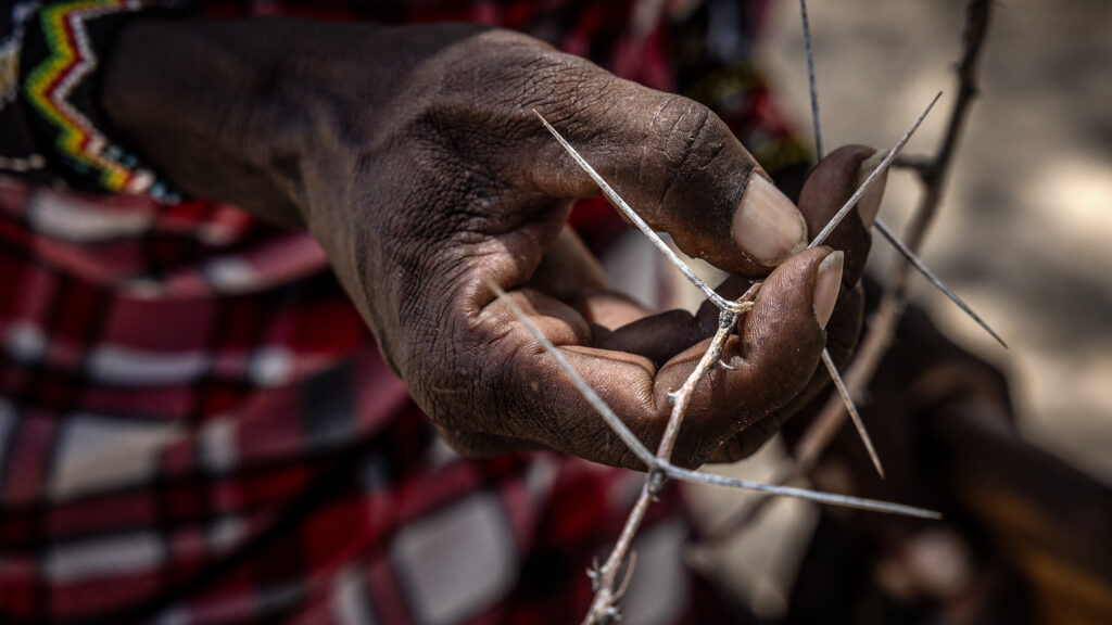 Source-feed image associated with Opinion: Ten years after WHO recognition, mycetoma remains one of the world’s most neglected diseases