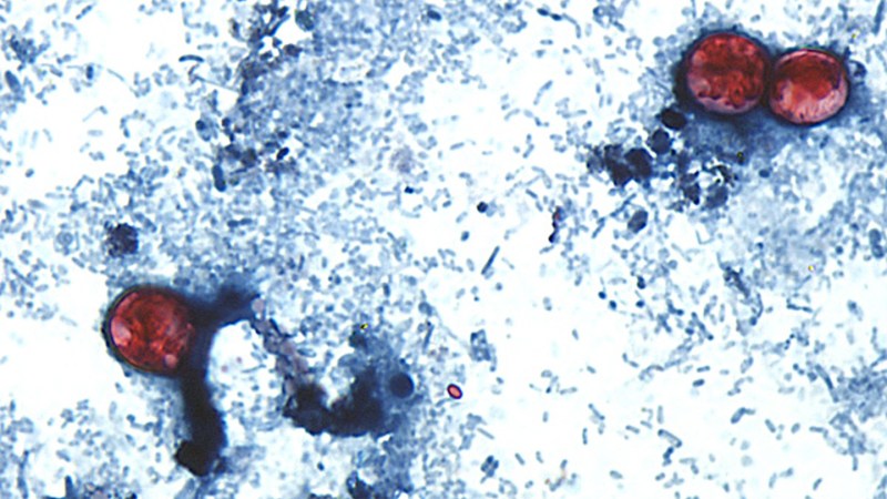 Source-feed image associated with Inside the fight against the parasite Cyclospora