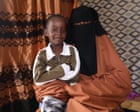 Image from linked report: Guardian readers fund life-changing surgery for Somali boy injured in US airstrike