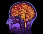 Image from linked report: The incredible science of memory manipulation – podcast