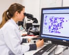 Source-feed image associated with Monday briefing: Are we any closer to a cure for cancer?
