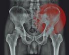 Image from linked report: Do we really ‘hold tension’ in our hips?