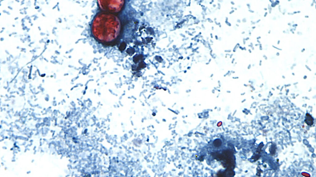 Source-feed image associated with A new, separate outbreak of the diarrhea-causing parasite