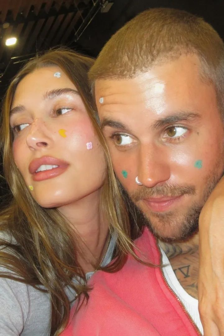 Source-feed image associated with Hailey Bieber Is Healing Her Blisters With…Pimple Patches?