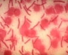 Source-feed image associated with AI can fuel biological weapons. We must harness its power for defense | Annie Jacobsen