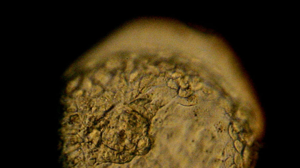 Source-feed image associated with STAT+: Next-gen CRISPR tools improve editing accuracy in embryos, but also stoke ethical concerns