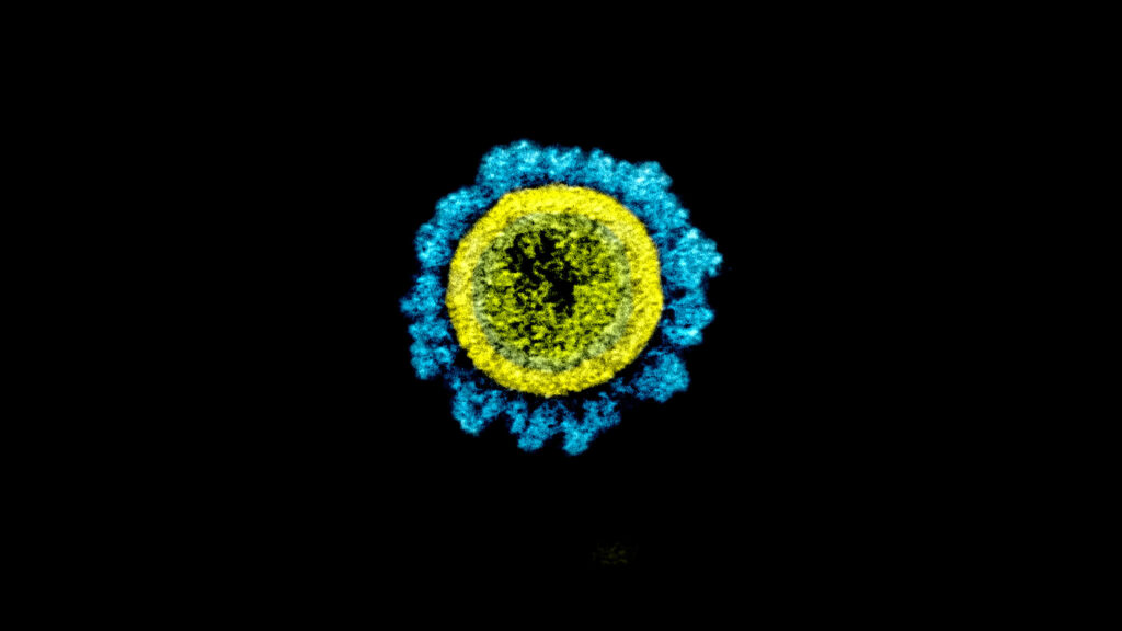 Source-feed image associated with Federal government could improve infectious disease monitoring, says federal government