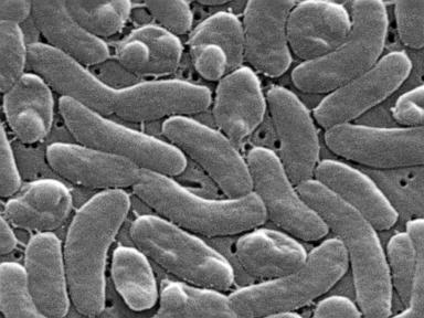 Source-feed image associated with Health officials urge caution for Gulf Coast beachgoers during surge of deadly bacterial infections