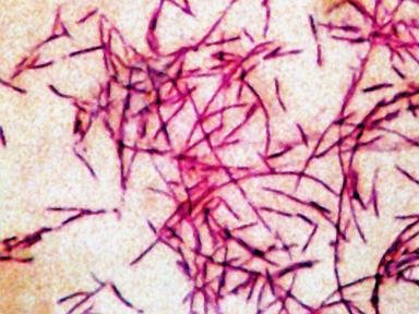 Source-feed image associated with 6th person dies from Legionnaires' disease in New York City: Health officials