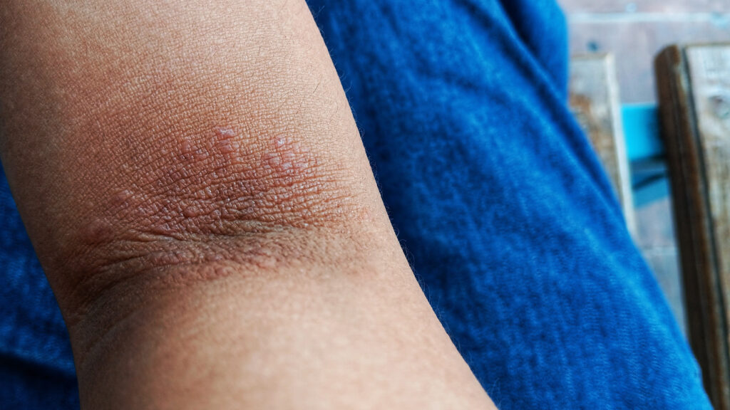 Source-feed image associated with STAT+: A biotech hedge fund births a new immunology company