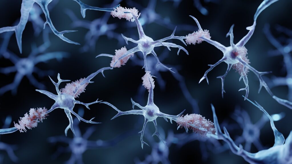 Source-feed image associated with STAT+: Verge Labs’ new AI model solves patient stratification problems for neurology clinical trials