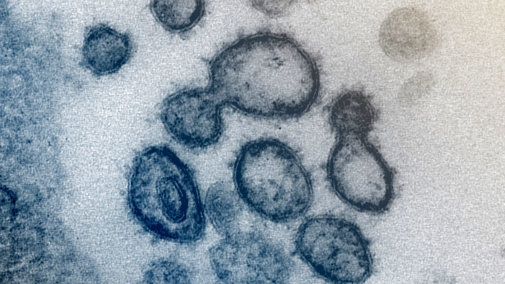 Source-feed image associated with Opinion: How long Covid’s scientific stalemate made it politically erasable