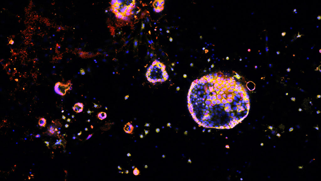 Source-feed image associated with STAT+: Europe will accelerate its review of RevMed’s drug