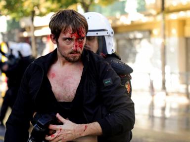 Image from linked report: Clashes erupt in Albania as protesting students join anti-government movement
