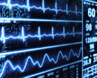 Source-feed image associated with ‘Superhuman’ AI tool spots heart disease in less than 2 seconds