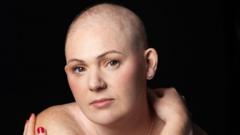 Source-feed image associated with Chemo hair loss doesn't define me - it's a symbol that I'm strong