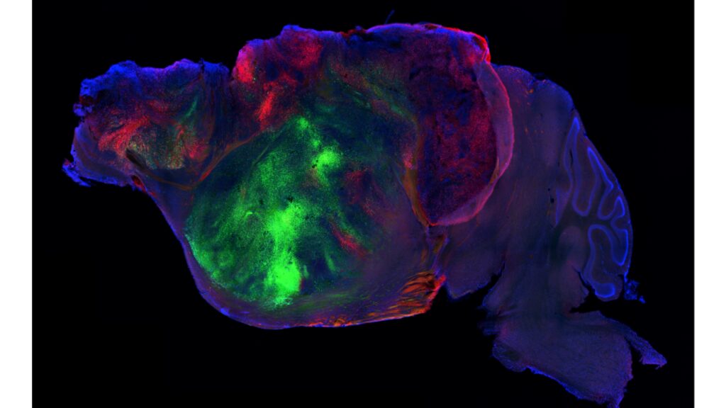 Source-feed image associated with STAT+: Scientists made mice with half a brain. Then they filled them with human organoids