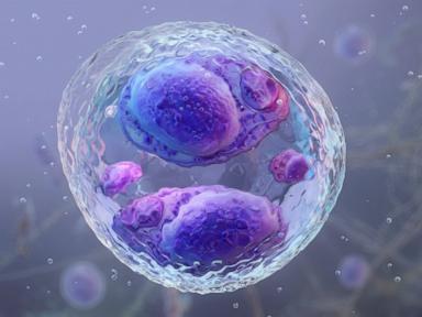 Source-feed image associated with 2 deaths reported in Michigan as cyclosporiasis outbreak continues to spread