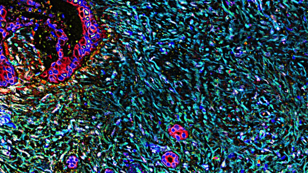 Source-feed image associated with Does Revolution Medicines’ pancreatic cancer drug have even greater potential?