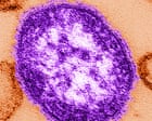 Source-feed image associated with Six-week-old child in Pennsylvania dies from measles, coroner says