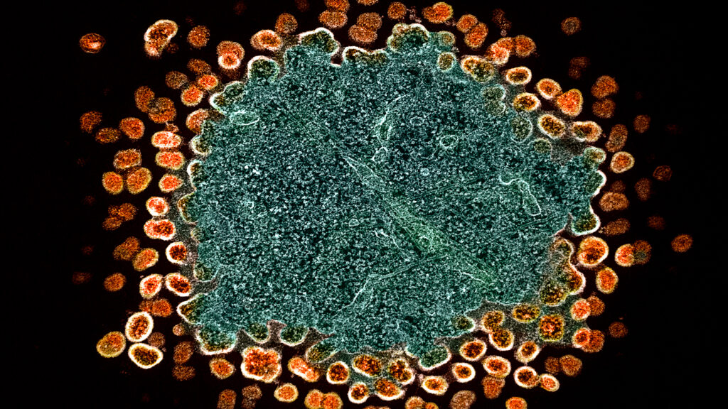 Source-feed image associated with Scientists uncover a new hiding spot for HIV