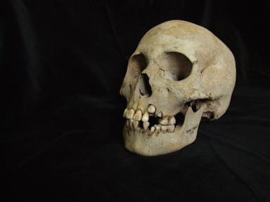 Source-feed image associated with Ancient teeth rewrite the plague's timeline, dating back to over 5,500 years ago