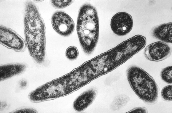 Source-feed image associated with New York City Reports Cases of Legionnaires’ Disease Rise to 23
