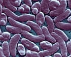 Source-feed image associated with Louisiana warns beachgoers amid surge in flesh-eating bacteria infections
