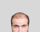 Image from linked report: 20 fascinating facts about hair: why baldness is super-masculine – and a pubic bush could be a ‘cheating detector’