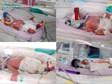 Source-feed image associated with WATCH: Woman gives birth to rare identical quadruplets