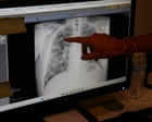 Source-feed image associated with We know how to prevent black lung, so why are workers still dying?