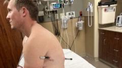 Source-feed image associated with Man impaled by a hiking pole treks 10 miles down mountain