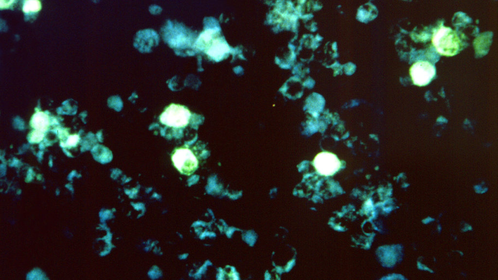Source-feed image associated with STAT+: New study untangles how Epstein-Barr viral infection triggers immune response in multiple sclerosis