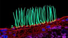 Image from linked report: Tiny image sparks big backlash in Nikon photo contest