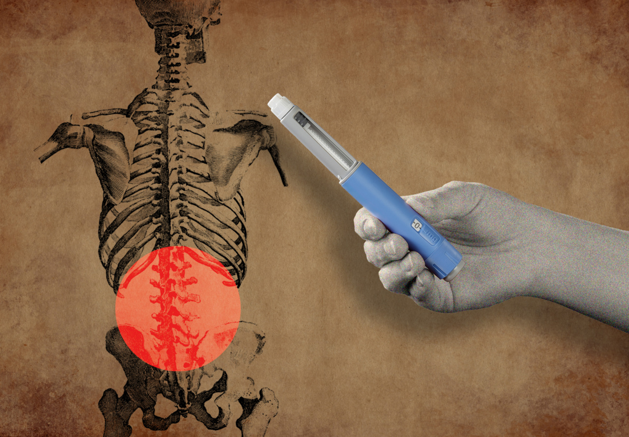 Image from linked report: GLP-1s could offer unexpected relief from back and knee pain, but doctors urge caution
