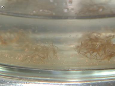 Source-feed image associated with WATCH: Scientists warn of invasive jellyfish on East coast