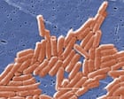 Source-feed image associated with Climate crisis is accelerating antibiotic resistance across world, study says