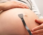 Source-feed image associated with Scientists create wearable ultrasound to continuously monitor babies in womb
