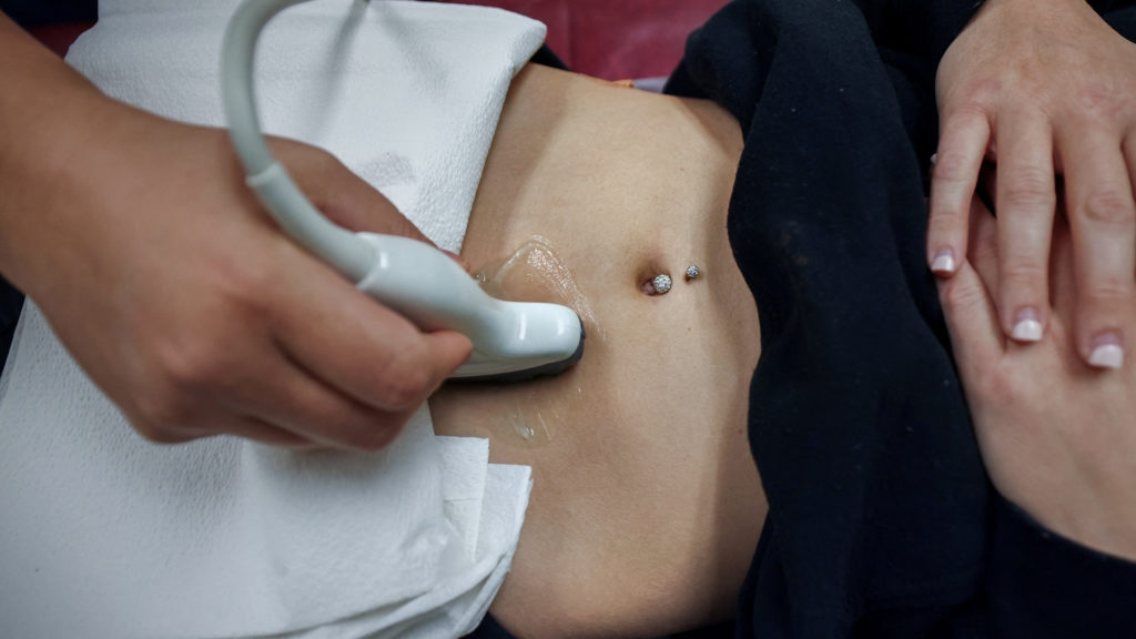 Source-feed image associated with How state abortion bans are affecting doctors and how they practice