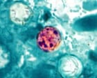 Source-feed image associated with US cyclosporiasis outbreak kills two people in Michigan, officials say