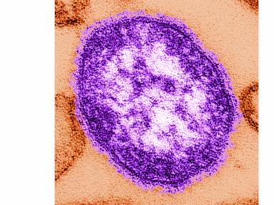 Source-feed image associated with Coroner releases details of infants who died amid growing measles outbreak